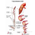 MF0220 3D Medical Anatomical PVC Chart - Blood Vessel